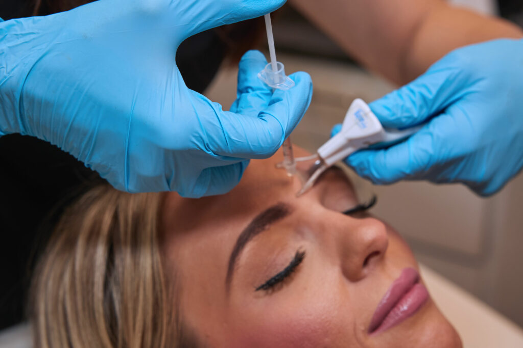 botox, dysport, soften fine lines and wrinkles